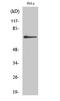 Adrenoceptor Beta 2 antibody, STJ91727, St John