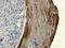 C-Type Lectin Domain Family 4 Member C antibody, orb13622, Biorbyt, Immunohistochemistry paraffin image 