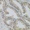 Vasoactive Intestinal Peptide antibody, 14-487, ProSci, Immunohistochemistry paraffin image 