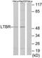 Lymphotoxin Beta Receptor antibody, TA314162, Origene, Western Blot image 