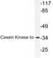 Casein Kinase 1 Alpha 1 antibody, LS-C176683, Lifespan Biosciences, Western Blot image 