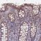 Lysine Rich Coiled-Coil 1 antibody, PA5-61050, Invitrogen Antibodies, Immunohistochemistry frozen image 