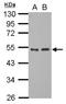 General Transcription Factor IIA Subunit 1 antibody, NBP2-16760, Novus Biologicals, Western Blot image 