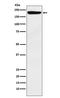 IQ Motif Containing GTPase Activating Protein 1 antibody, M01603, Boster Biological Technology, Western Blot image 