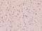 McKusick-Kaufman Syndrome antibody, 102725-T08, Sino Biological, Immunohistochemistry paraffin image 