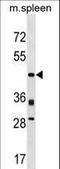 Proline Rich 5 antibody, LS-C158237, Lifespan Biosciences, Western Blot image 