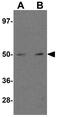 Ribosomal Oxygenase 2 antibody, GTX31403, GeneTex, Western Blot image 