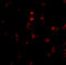 Apoptosis Antagonizing Transcription Factor antibody, A03945, Boster Biological Technology, Immunofluorescence image 