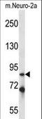 Interleukin 1 Receptor Associated Kinase 1 antibody, LS-C164426, Lifespan Biosciences, Western Blot image 