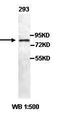 Adenosine Monophosphate Deaminase 1 antibody, orb77435, Biorbyt, Western Blot image 