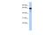 Deleted In Azoospermia 1 antibody, A03380, Boster Biological Technology, Western Blot image 