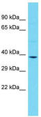 CXADR Like Membrane Protein antibody, TA338676, Origene, Western Blot image 