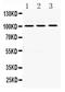 RAS P21 Protein Activator 1 antibody, PA5-79915, Invitrogen Antibodies, Western Blot image 