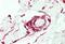 Collagen Triple Helix Repeat Containing 1 antibody, MBS249099, MyBioSource, Immunohistochemistry paraffin image 