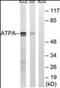 ATP Synthase F1 Subunit Alpha antibody, orb94899, Biorbyt, Western Blot image 