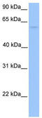 Chaperonin Containing TCP1 Subunit 6B antibody, TA335679, Origene, Western Blot image 