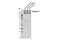 ATP Binding Cassette Subfamily C Member 3 antibody, 39909S, Cell Signaling Technology, Western Blot image 
