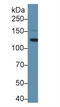 LIF Receptor Subunit Alpha antibody, LS-C295141, Lifespan Biosciences, Western Blot image 