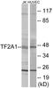 General Transcription Factor IIA Subunit 1 antibody, EKC1742, Boster Biological Technology, Western Blot image 