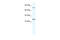 Zinc Finger Protein 337 antibody, 28-740, ProSci, Western Blot image 