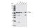 Beta-Transducin Repeat Containing E3 Ubiquitin Protein Ligase antibody, 4394S, Cell Signaling Technology, Western Blot image 