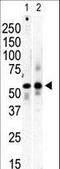 Phosphatidylinositol 4-Kinase Type 2 Beta antibody, LS-C101108, Lifespan Biosciences, Western Blot image 