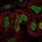 Protein Kinase, DNA-Activated, Catalytic Subunit antibody, MA5-15813, Invitrogen Antibodies, Immunofluorescence image 