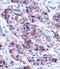 Lactalbumin Alpha antibody, A04858, Boster Biological Technology, Immunohistochemistry paraffin image 