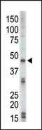 Serine/Threonine Kinase 17b antibody, MBS9206059, MyBioSource, Western Blot image 