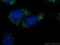 CF Transmembrane Conductance Regulator antibody, 20738-1-AP, Proteintech Group, Immunofluorescence image 