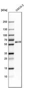 Regulator Of Microtubule Dynamics 3 antibody, PA5-52680, Invitrogen Antibodies, Western Blot image 