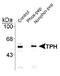 TPH1 antibody, NB300-307, Novus Biologicals, Western Blot image 