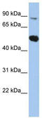 SRY-Box 6 antibody, TA331894, Origene, Western Blot image 