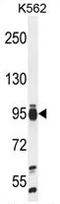 TATA-Box Binding Protein Associated Factor 4b antibody, AP54146PU-N, Origene, Western Blot image 