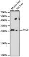 PEST Proteolytic Signal Containing Nuclear Protein antibody, GTX66386, GeneTex, Western Blot image 