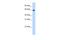 E3 ubiquitin-protein ligase RNF6 antibody, PA5-68868, Invitrogen Antibodies, Western Blot image 