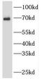 Serum Response Factor antibody, FNab08222, FineTest, Western Blot image 