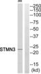 Stathmin 3 antibody, abx014926, Abbexa, Western Blot image 