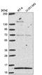 General Transcription Factor IIA Subunit 2 antibody, HPA056239, Atlas Antibodies, Western Blot image 