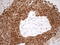 O-6-Methylguanine-DNA Methyltransferase antibody, LS-C798647, Lifespan Biosciences, Immunohistochemistry paraffin image 