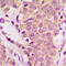 SHC-transforming protein 1 antibody, GTX54986, GeneTex, Immunohistochemistry paraffin image 