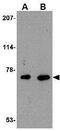 Apoptosis Inducing Factor Mitochondria Associated 3 antibody, GTX17002, GeneTex, Western Blot image 