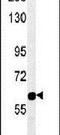 Rap Associating With DIL Domain antibody, PA5-23742, Invitrogen Antibodies, Western Blot image 