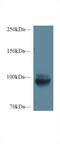 Meprin A Subunit Alpha antibody, MBS2007280, MyBioSource, Western Blot image 