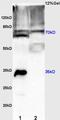 Ribosomal Protein S6 Kinase B2 antibody, orb6618, Biorbyt, Western Blot image 