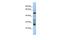 Testis Expressed 47 antibody, GTX45266, GeneTex, Western Blot image 