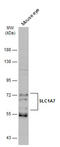 Excitatory amino acid transporter 5 antibody, GTX134113, GeneTex, Western Blot image 