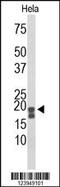 Acid Phosphatase antibody, 63-933, ProSci, Western Blot image 