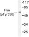 FYN Proto-Oncogene, Src Family Tyrosine Kinase antibody, LS-C177902, Lifespan Biosciences, Western Blot image 