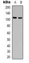 GTF2I Repeat Domain Containing 1 antibody, LS-C368678, Lifespan Biosciences, Western Blot image 